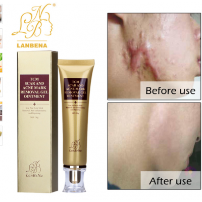 2018 Hottest Prodcuts LanBeNa Best Selling Skin Care Dark Spot Whitening Acne Free gel Face Acne Scar Removal Cream 30ml